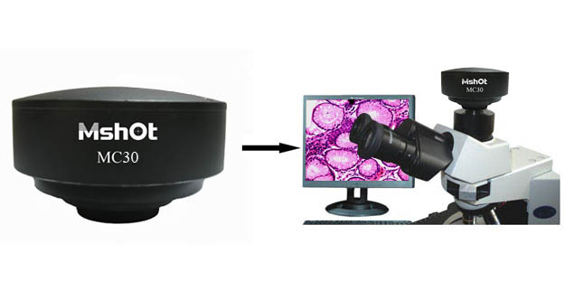 CCD Microscope Camera