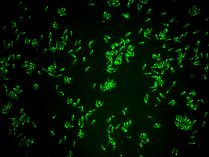 GFP,fluorescence microscope