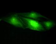 GFP,fluorescence microscope