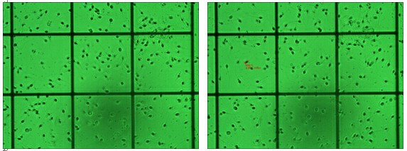 数码成像系统在精子检测中的应用