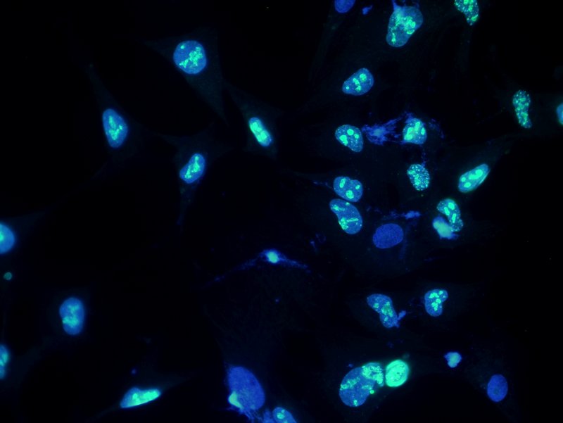 12_InvFluo_MF52_MF-BGU-LED2.jpg