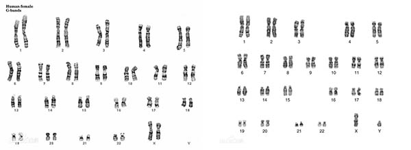 01_InvFluo_MF52-N12.jpg