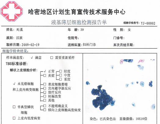 TCT检测